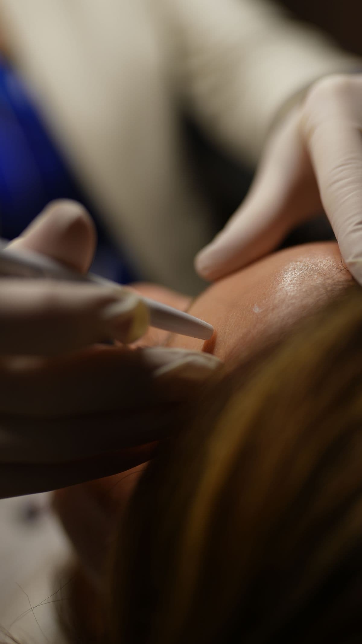 A refined facial skin treatment